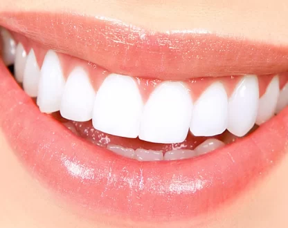 Can Cosmetic Dentistry Improve The Quality Of Life?