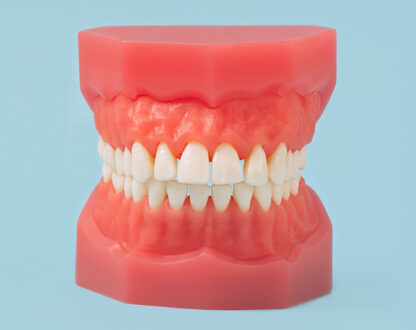 Everything You Need to Know About Dentures in Smithfield