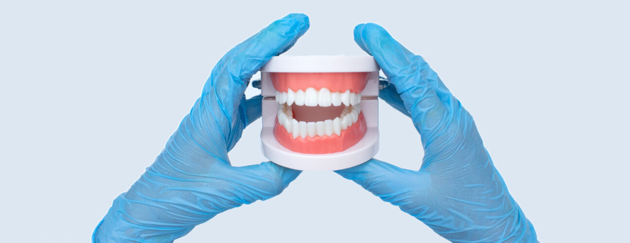 How to Fix a Cracked Denture Plate?