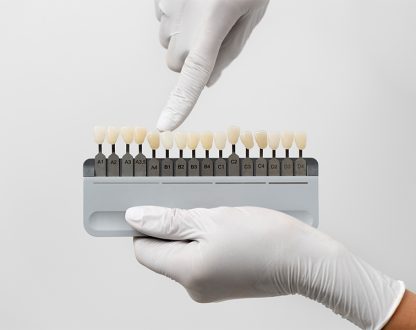How Dental Veneers Can Improve Severe Tooth Discoloration